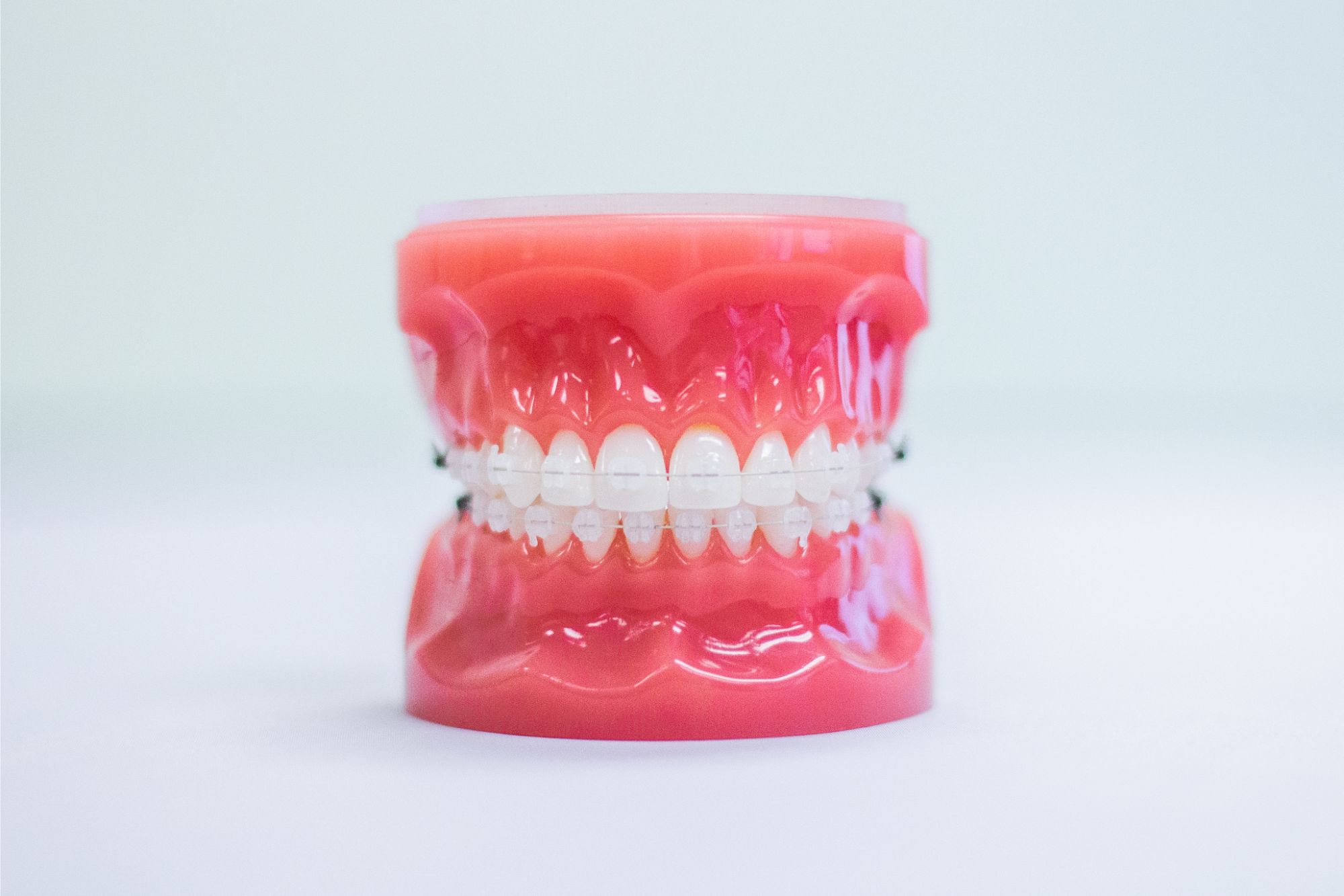 clear cermaic braces